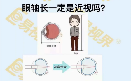 眼軸長一定是近視嗎？